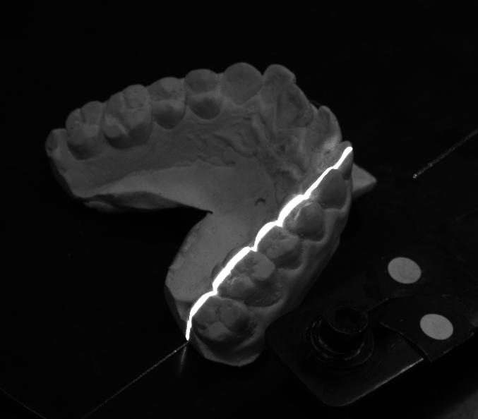 图5 义齿扫描重建 焊缝跟踪定位